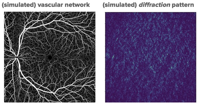 Example synthetic data from glaucoma and vasculature diffraction dataset